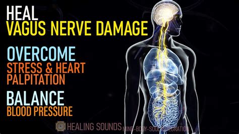 So, the person may experience breathing difficulty. . Vagus nerve heart palpitations